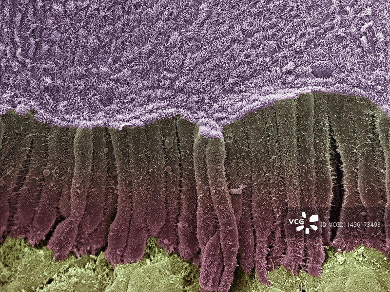 胆管扫描电镜图图片素材