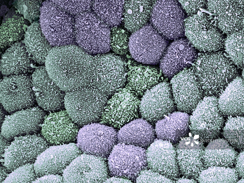 胆囊表面扫描电镜图图片素材