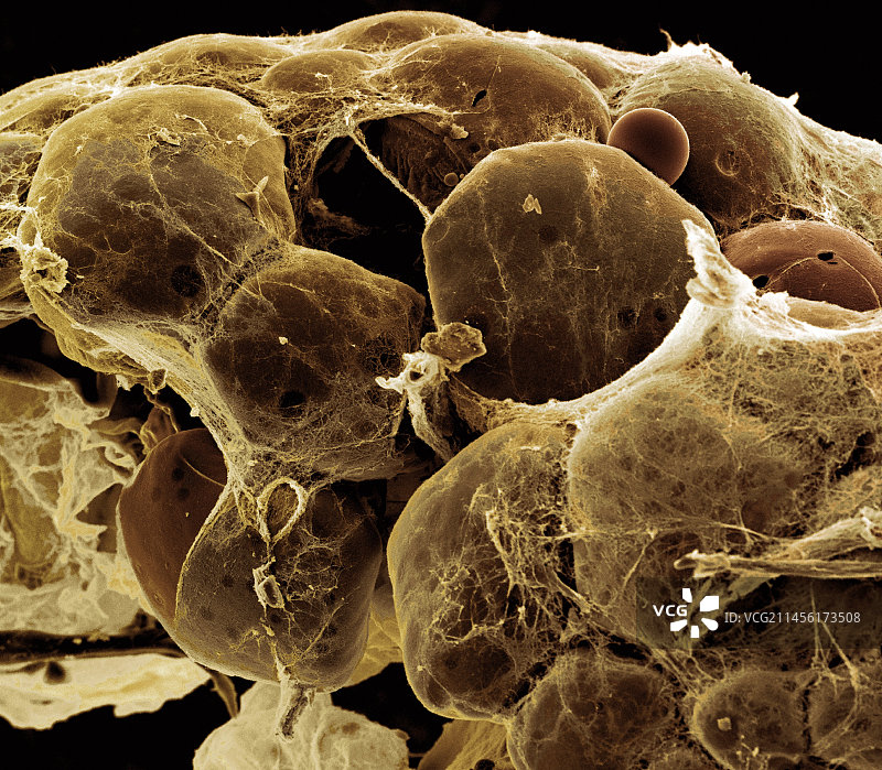 脂肪组织扫描电镜图片素材