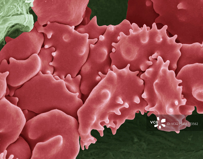 皱缩的红细胞（扫描电子显微镜）图片素材