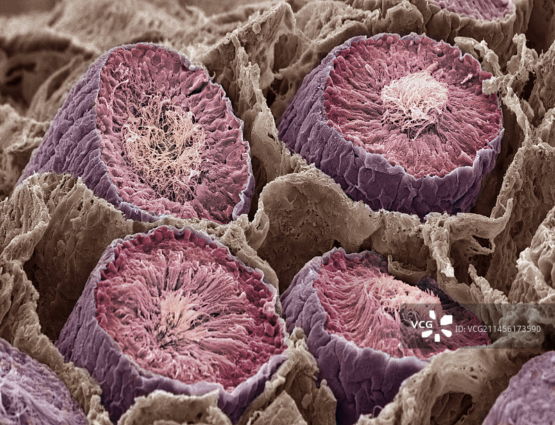 精子产生（扫描电子显微镜图像）图片素材