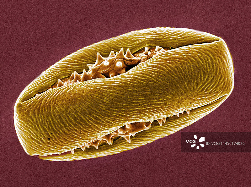 欧洲七叶树花粉扫描电镜图图片素材