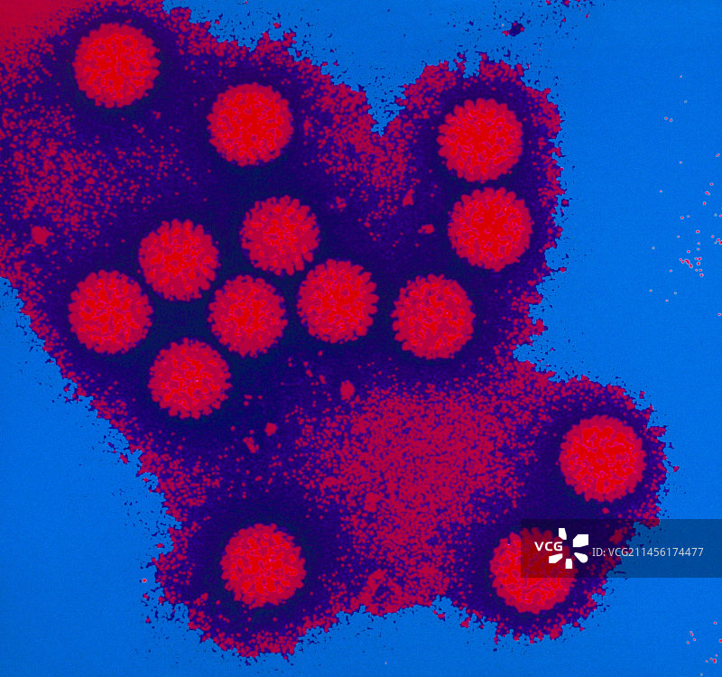彩色透射电镜下的轮状病毒群图片素材