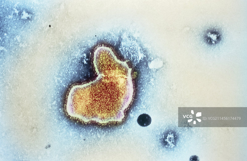 呼吸道合胞病毒图片素材