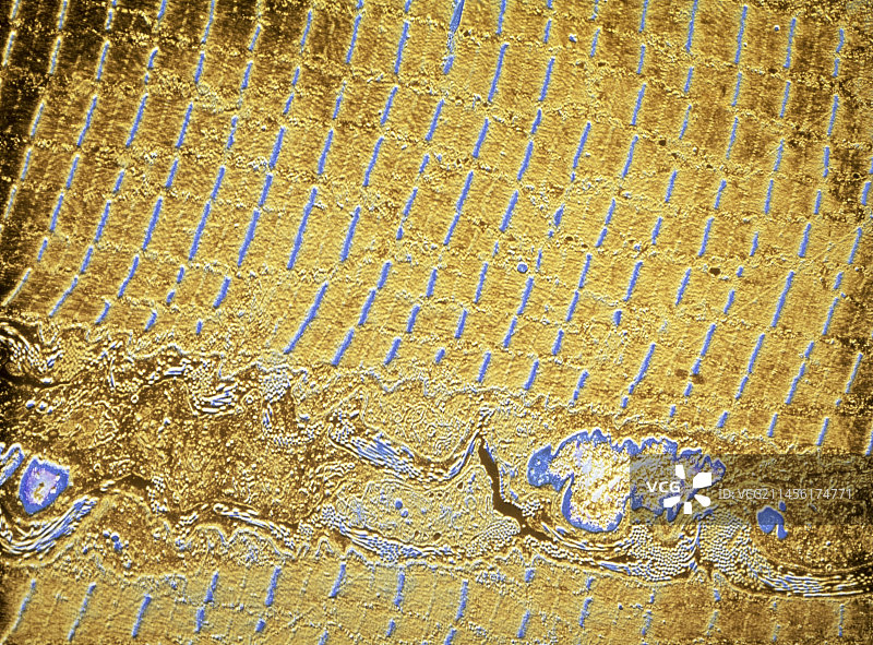 骨骼肌图片素材