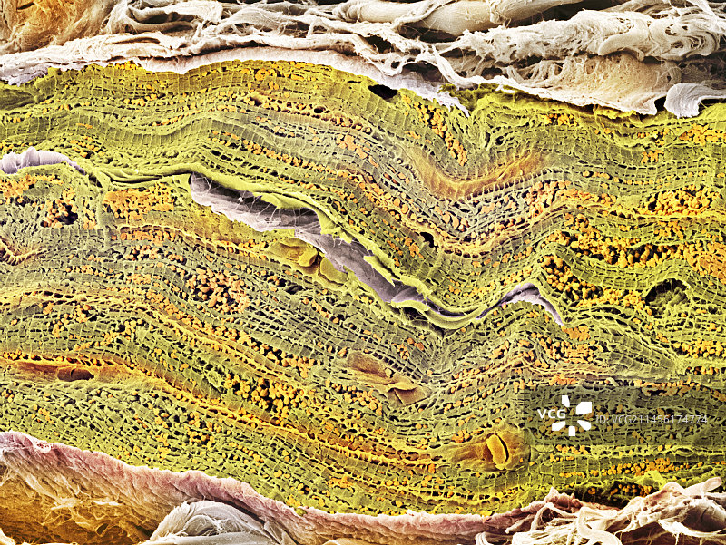 心肌扫描电镜图图片素材