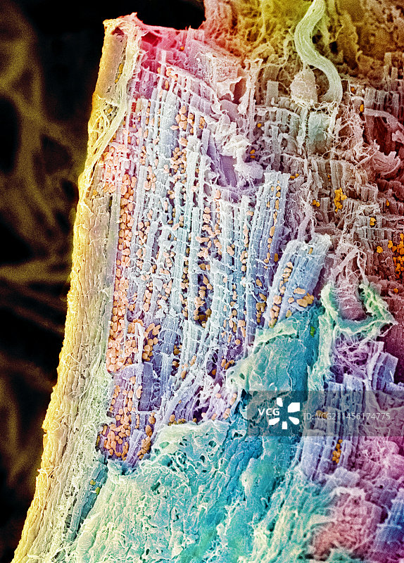 心肌扫描电镜图图片素材