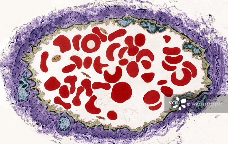 动脉，TEM图片素材