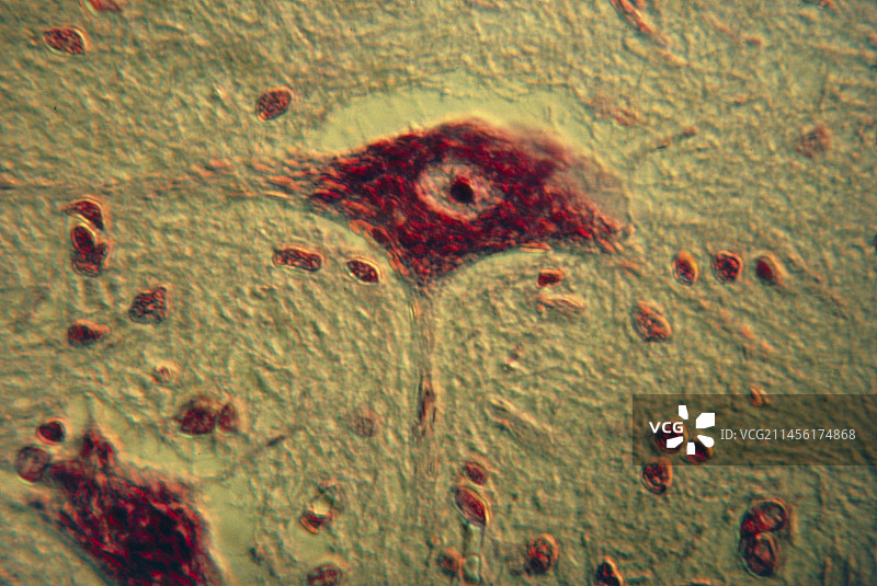 神经细胞图片素材