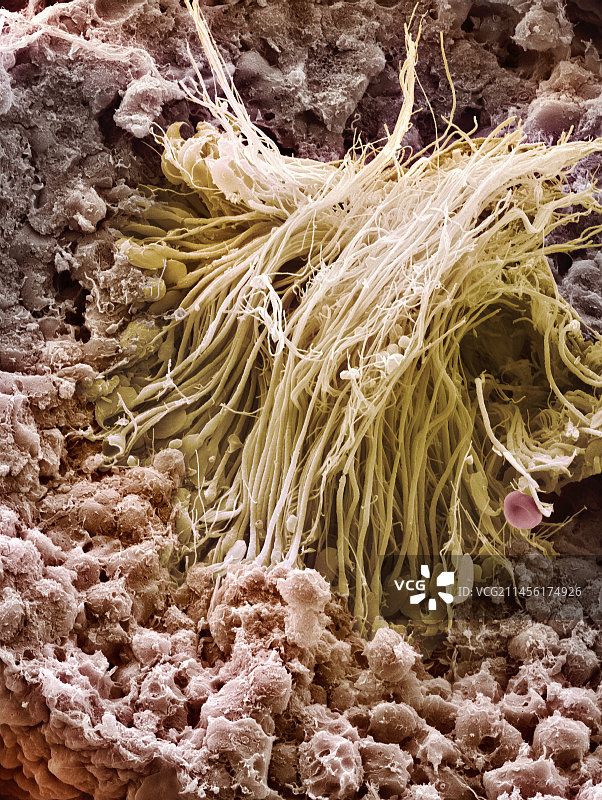 精子产生部位，扫描电子显微镜图片素材