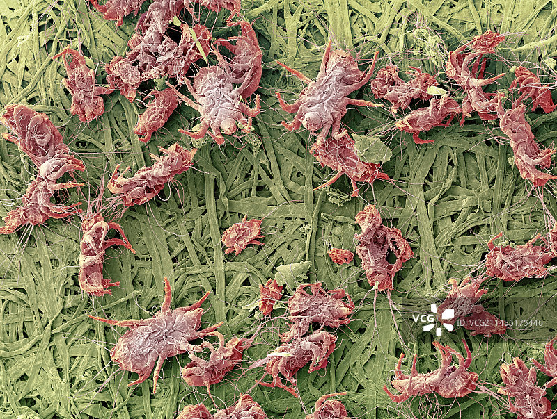 尘螨扫描电镜图图片素材