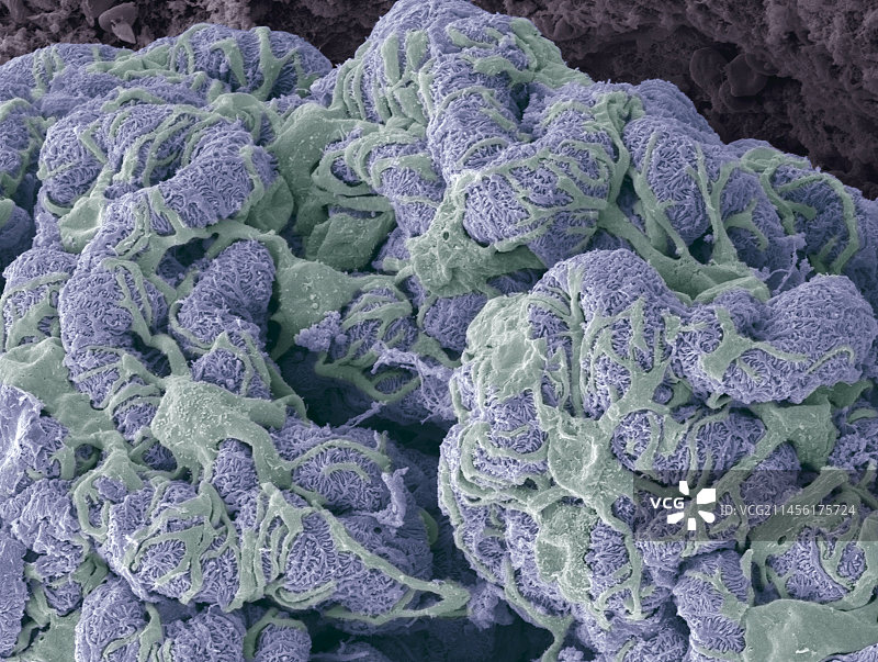 肾小球扫描电镜图图片素材