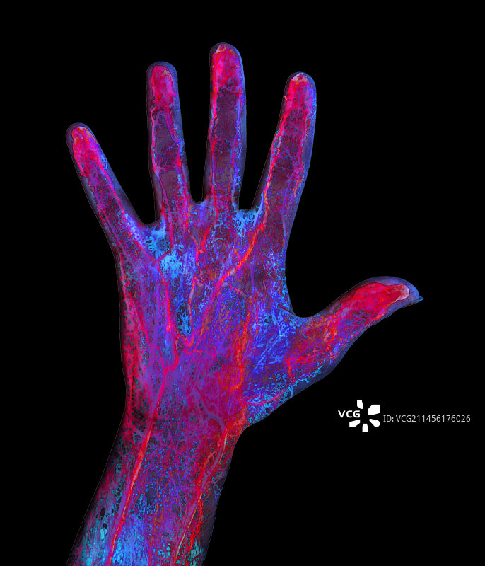 手部血液供应艺术图图片素材