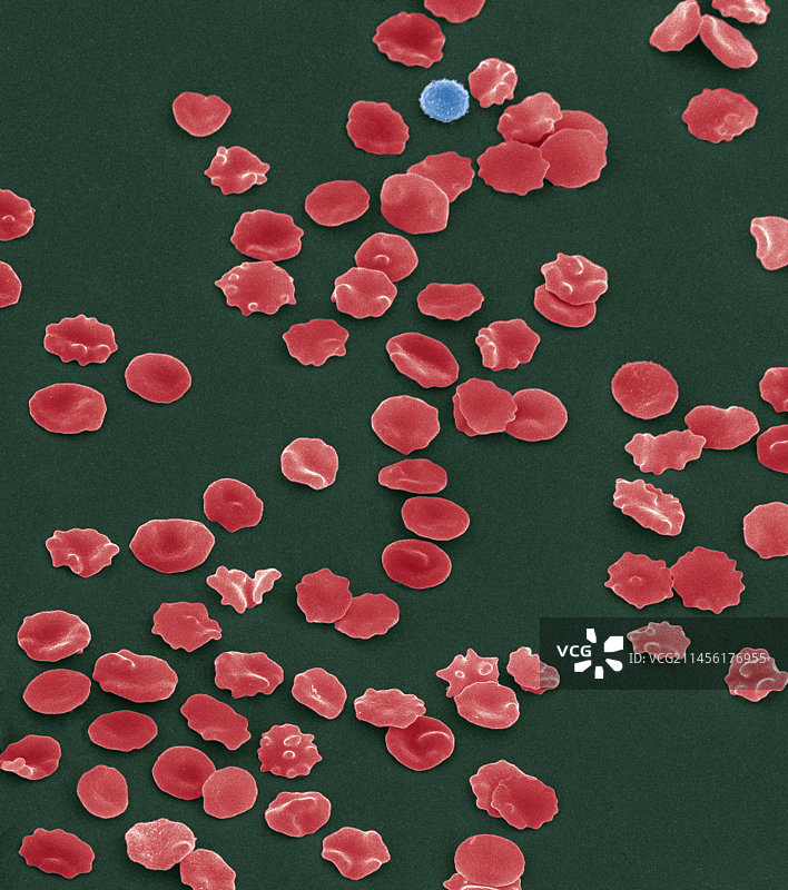 血细胞扫描电镜图图片素材