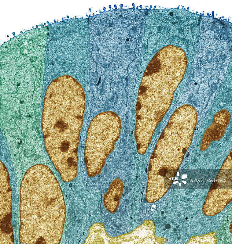 输卵管，TEM图片素材