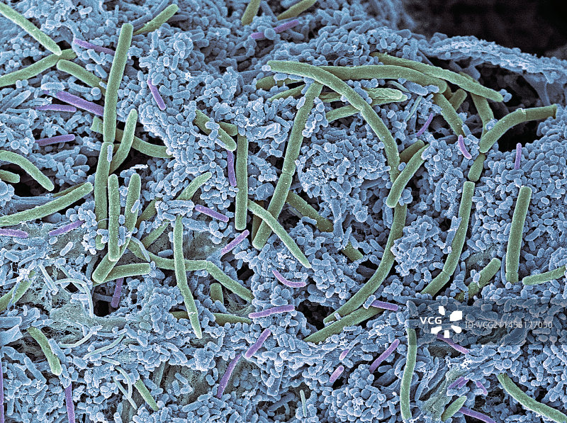 牙菌斑扫描电镜图图片素材