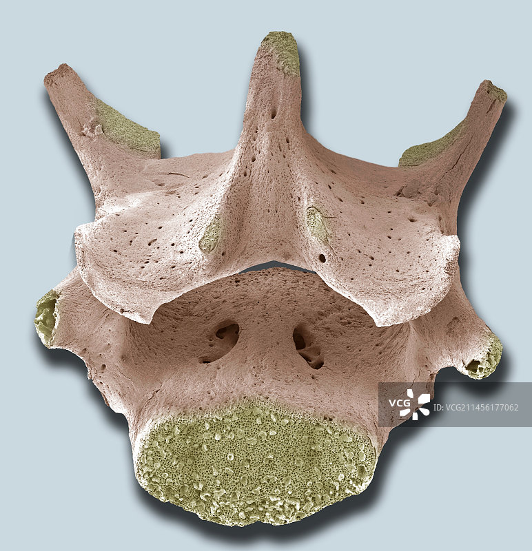 脊椎骨扫描电镜图图片素材