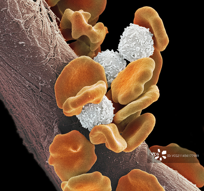 白血病血细胞图片素材