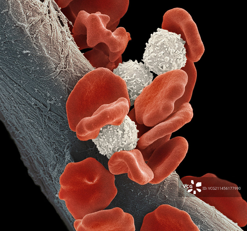白血病血细胞图片素材