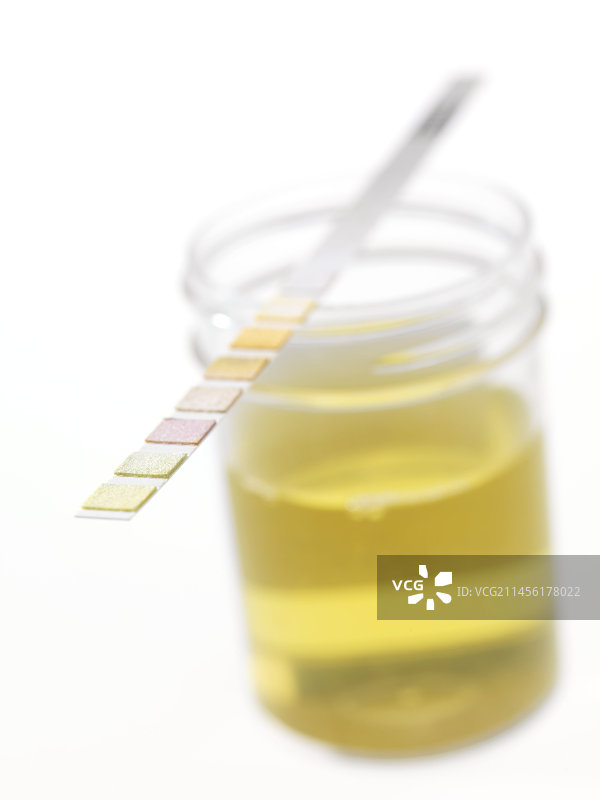 尿液分析图片素材