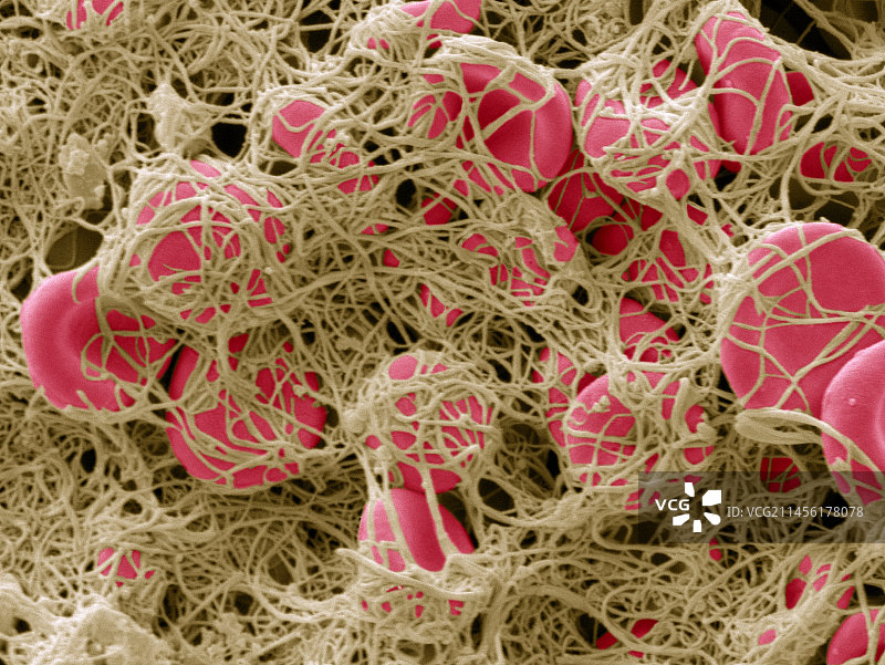 血栓扫描电镜图片素材
