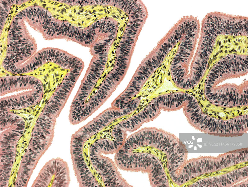 输卵管显微照片图片素材