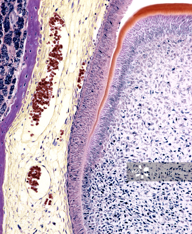 牙齿发育显微照片图片素材