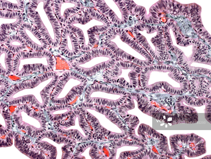 输卵管显微照片图片素材