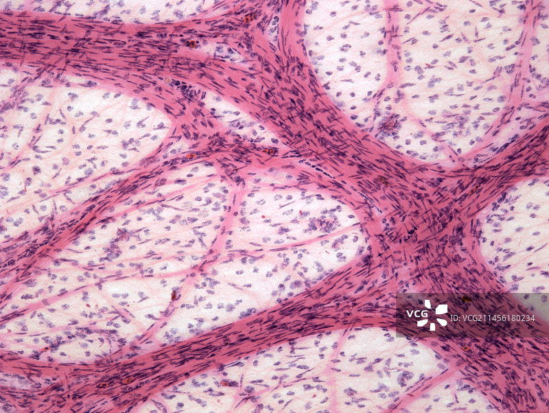 网膜组织切片显微照片图片素材