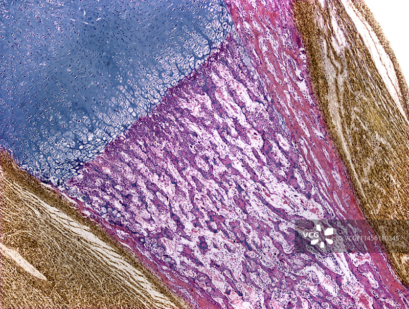骨骼发育显微照片图片素材