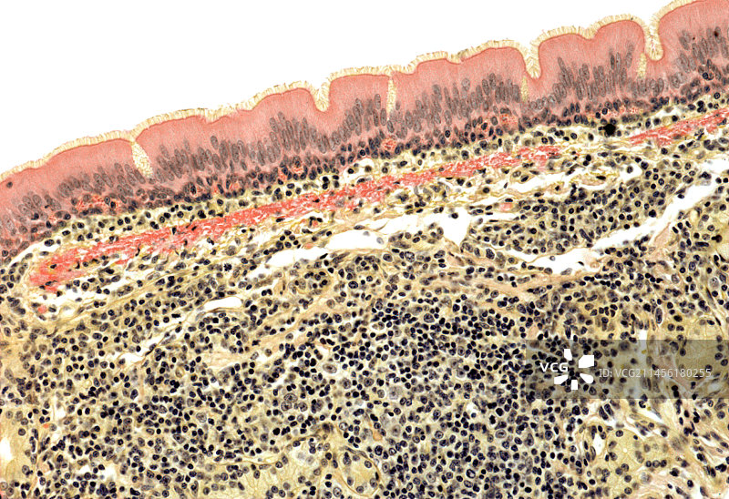 气管显微照片图片素材