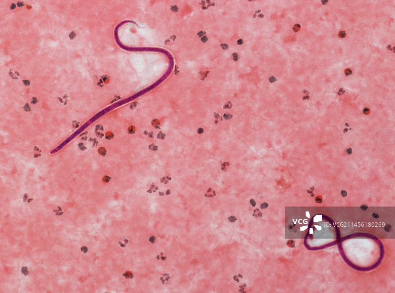 微丝蚴虫的显微照片图片素材