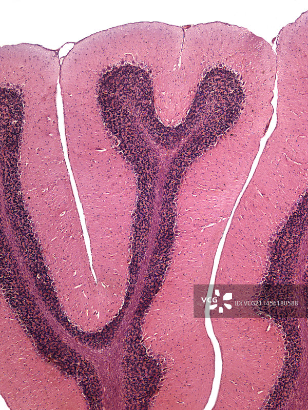 小脑显微照片图片素材