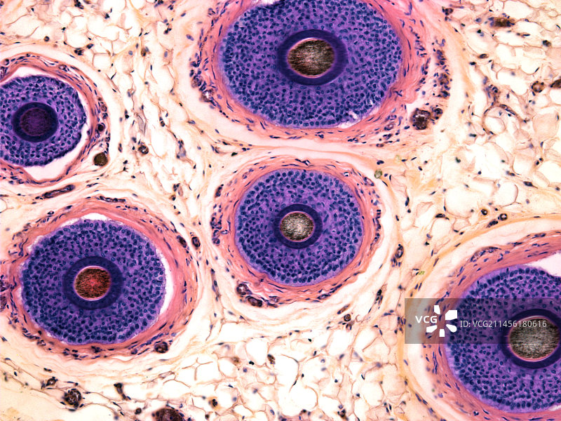 毛囊显微照片图片素材