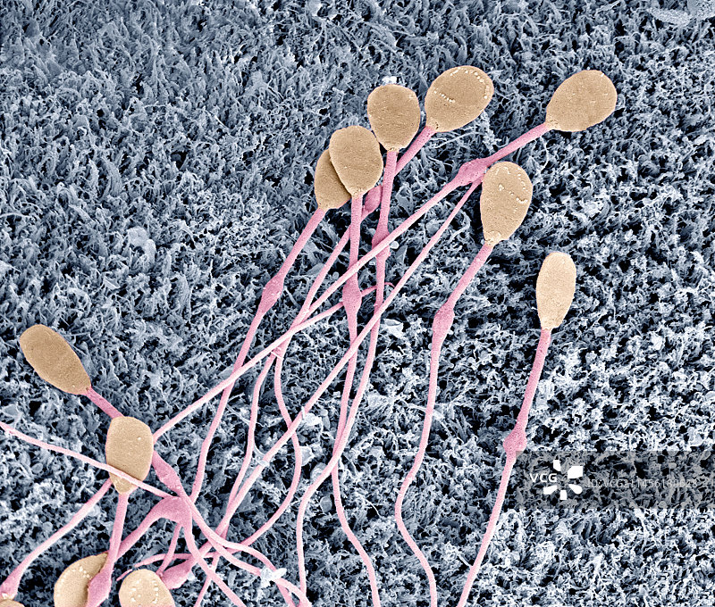 未成熟的犬精子细胞，扫描电镜图片素材