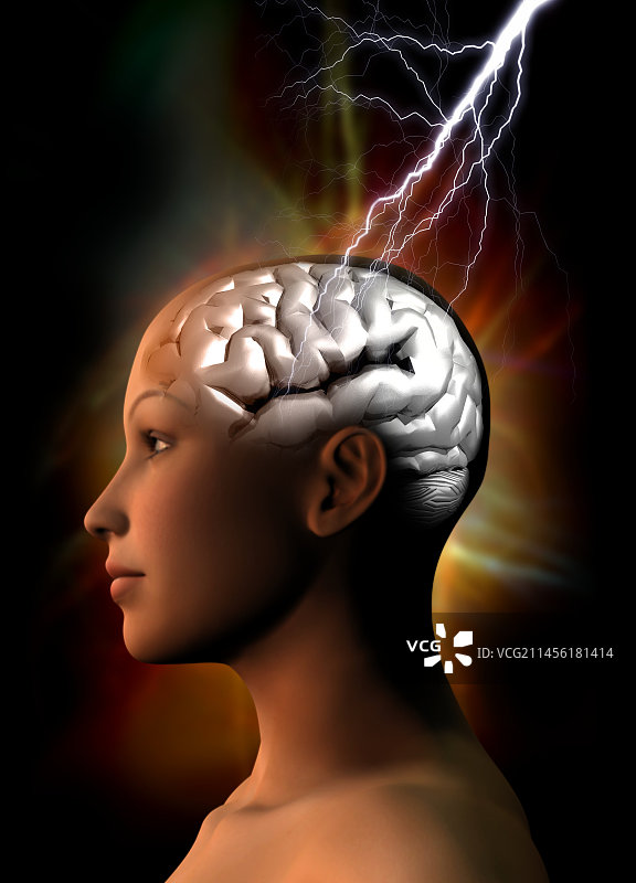 偏头痛概念艺术作品图片素材