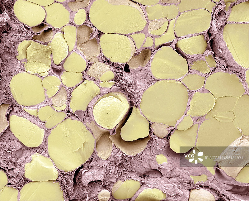 甲状腺，扫描电子显微镜图片素材