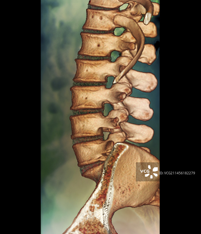 正常脊柱CT扫描图片素材