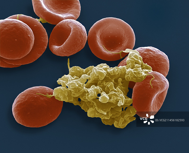 血细胞扫描电镜图图片素材