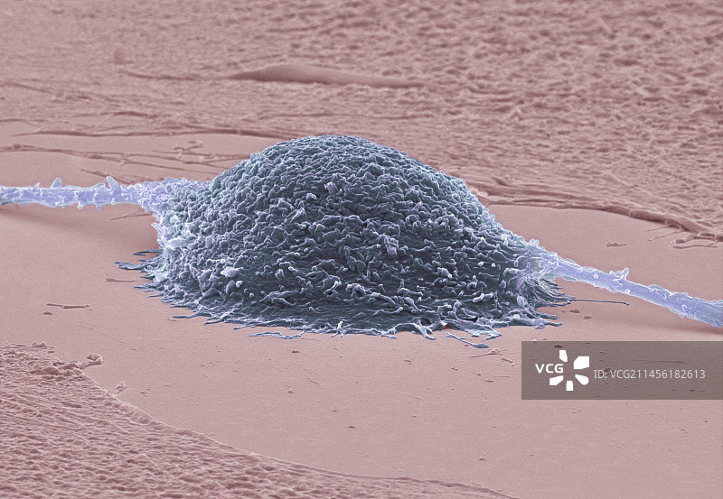 癌细胞分裂扫描电镜图图片素材