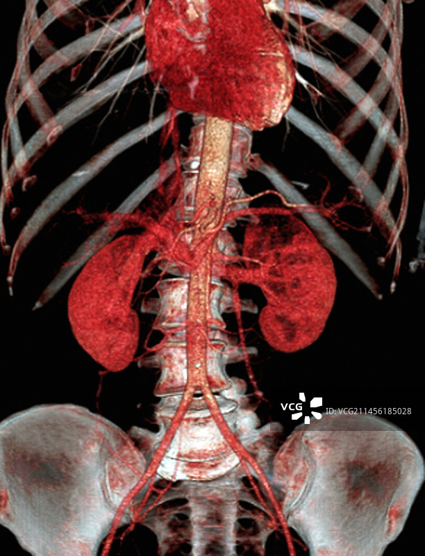 正常腹部3D CT扫描图片素材