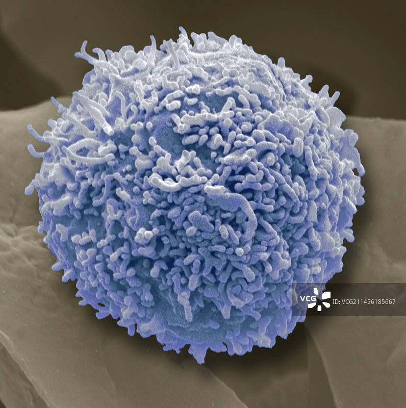 淋巴细胞白细胞，扫描电镜图图片素材