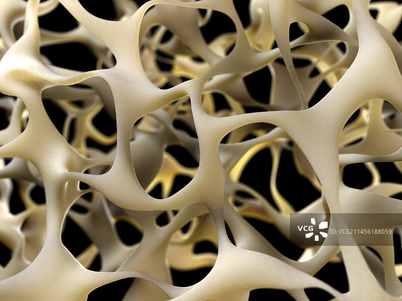 骨质疏松症骨骼图图片素材