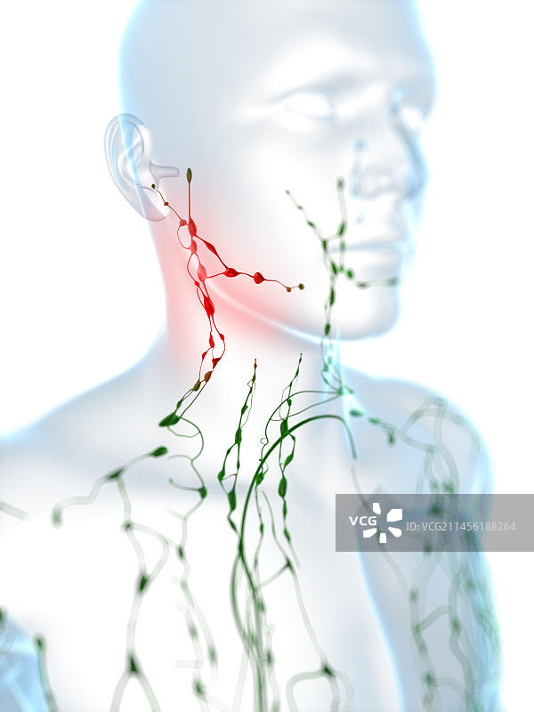 肿胀的淋巴结（艺术作品）图片素材