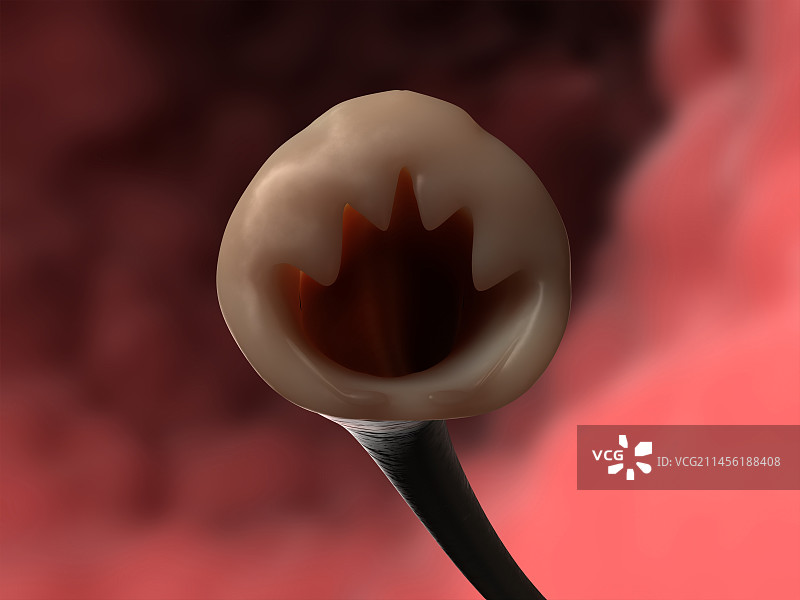 钩虫头部，艺术作品图片素材