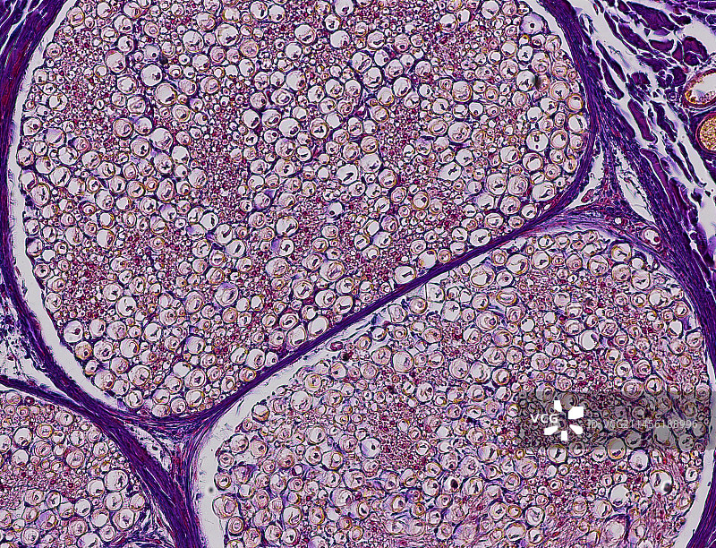 神经纤维，光学显微照片图片素材