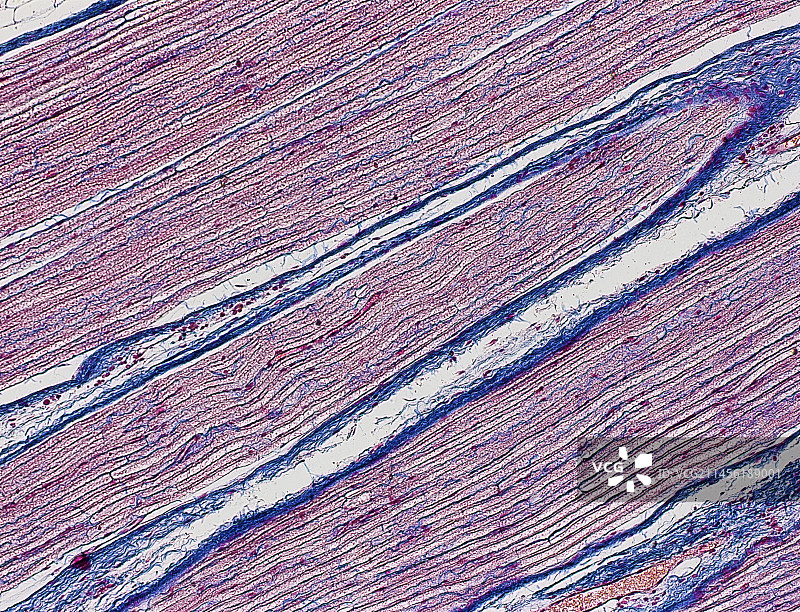 神经纤维，光学显微照片图片素材
