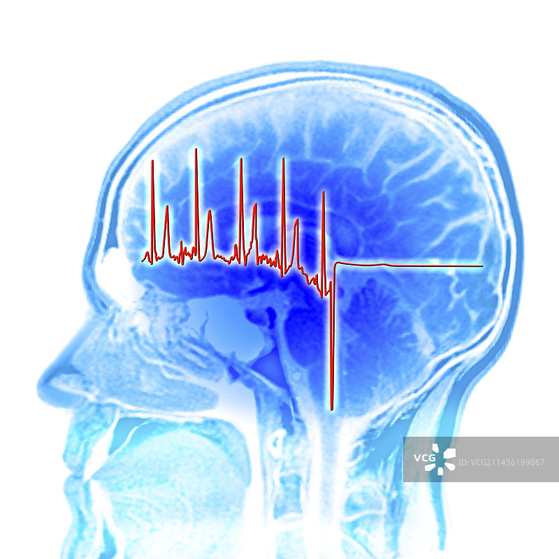 心电图轨迹和脑部核磁共振扫描图图片素材