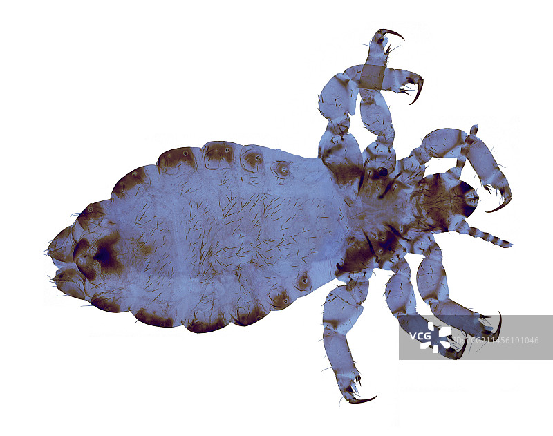 头虱显微照片图片素材