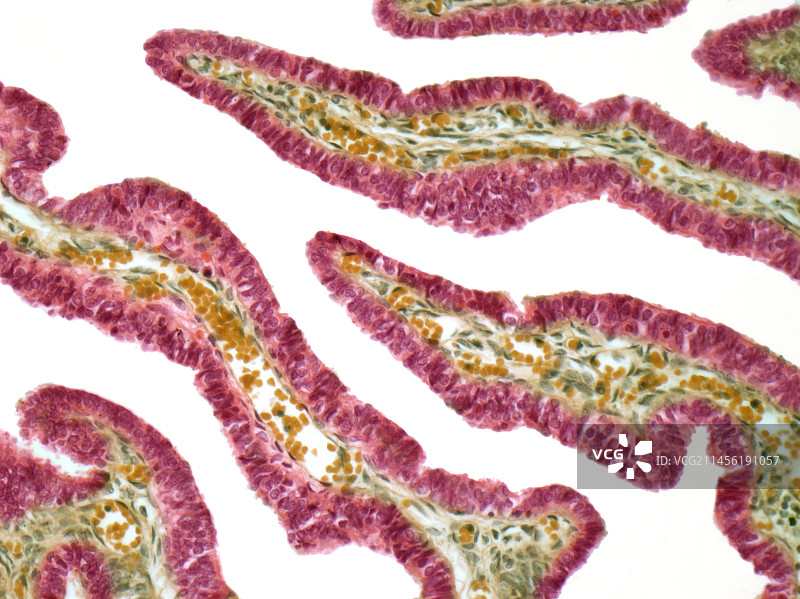 输卵管显微照片图片素材